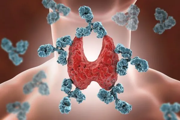 thyroid-diseases