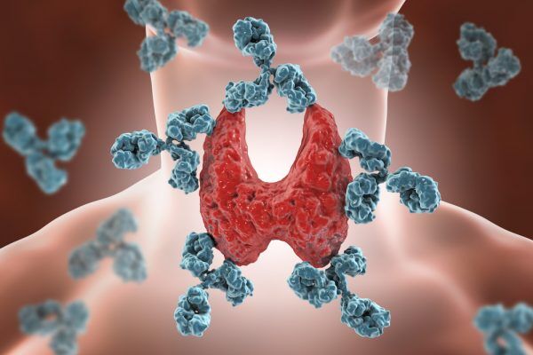 thyroid-diseases