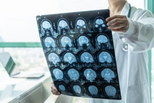 future of trt in neurodegenerative disease treatment