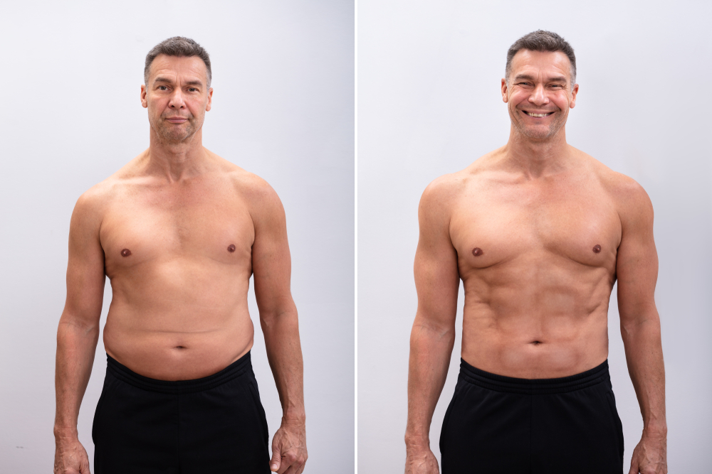 Feel Younger And Stronger With Testosterone Replacement Therapy At A Professional Clinic