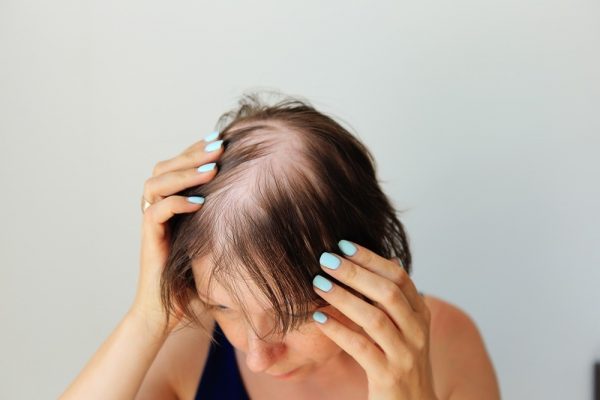 Are There Hormones That Can Help with Hair Regrowth
