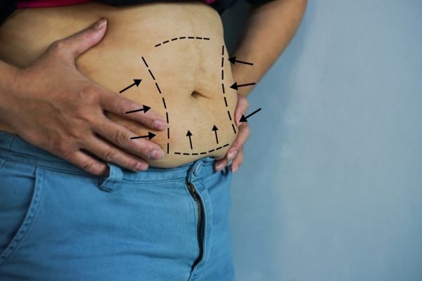 hormonal weight gain - medical weight loss vitality aesthetic